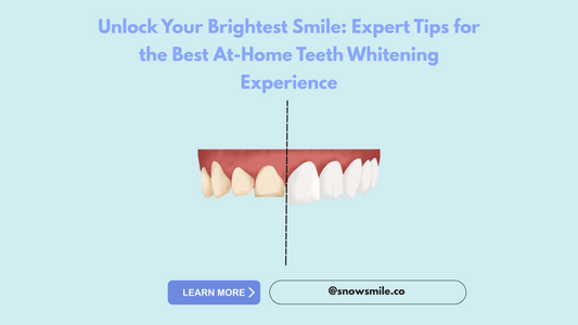 Unlock Your Brightest Smile: Expert Tips for the Best At-Home Teeth Whitening Experience