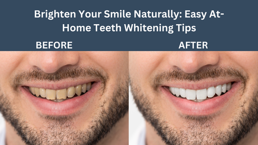 Natural Teeth Whitening Remedies: How to whiten your teeth naturally in 2024