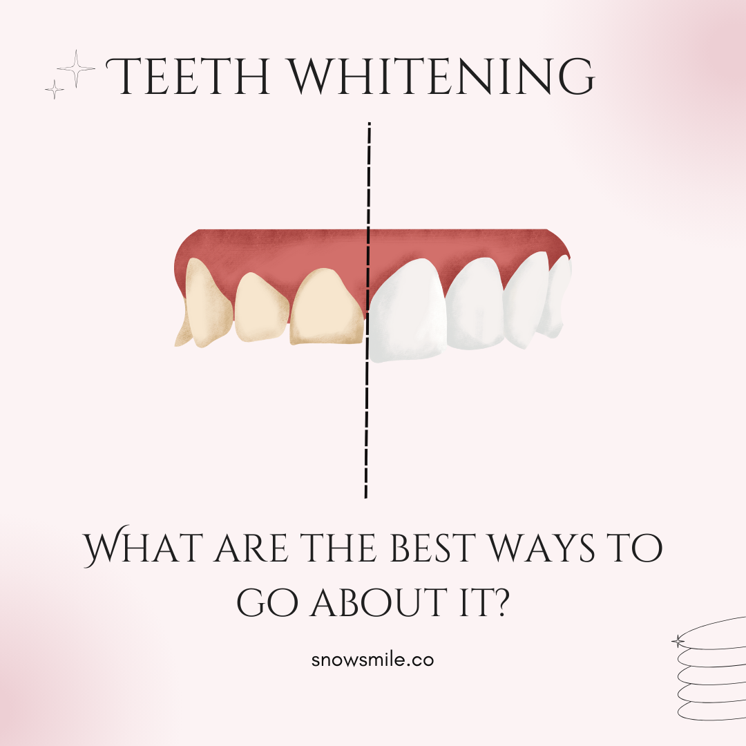 Teeth Whitening | What are the best ways to go about it?