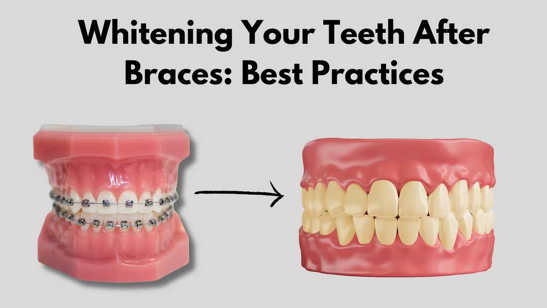 Whitening Your Teeth After Braces: Best Practices