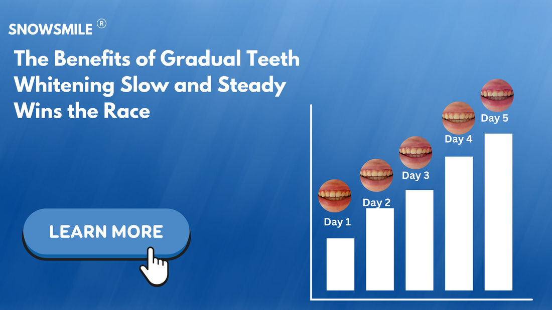 The ideal way to whiten teeth: Do it Gradually!